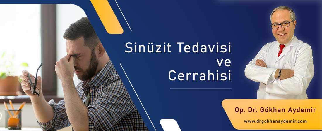 Sinüzit Tedavisi ve Cerrahisi